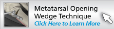 Metatarsal Opening Wedge Technique